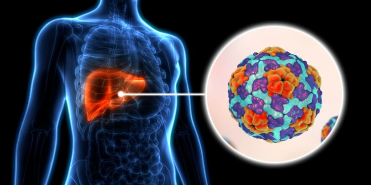 Smrtonosna epidemija hepatitisa A u Češkoj: Skijanje pod senkom virusa