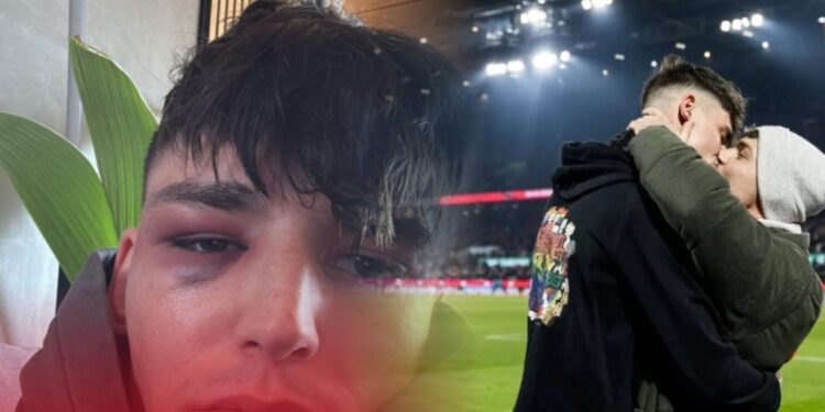 Gej sudija zaprosio partnera na stadionu u Kelnu: Pretučen u svom dvorištu