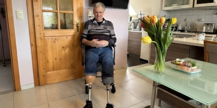 Posle odmora u Hrvatskoj ostao bez obe noge: Teška infekcija promenila život Austrijanca