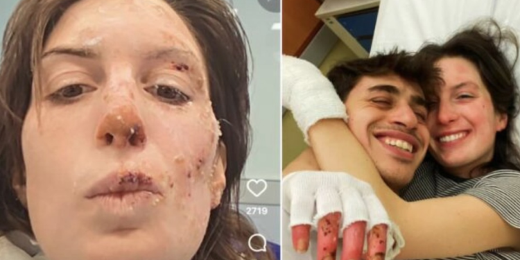 Švajcarska birokratija gazi žrtve: Povređeni učenici iz požara u Kran-Montani neće dobiti diplomu