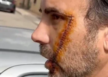 Žrtva napada u Malagi: „Niste kontrolisali granice. Lako ulazi ovaj šljam“