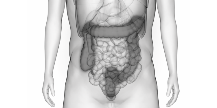 Zabrinjavajući trend iz Evrope: Tumor debelog creva pogađa mlađu populaciju