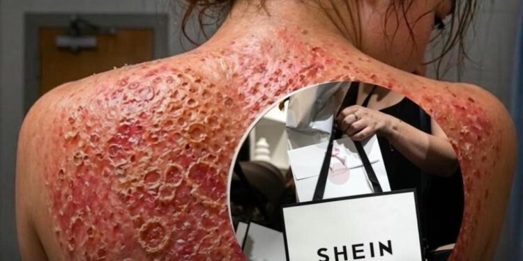 SHEIN na sudu: Otkrivene otrovne hemikalije i do 3.269 puta iznad dozvoljenog