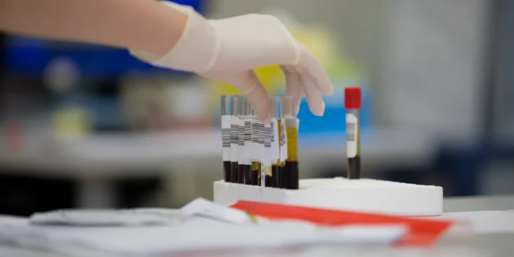 Laboratorijski rad sa uzorcima krvi