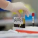 Laboratorijski rad sa uzorcima krvi