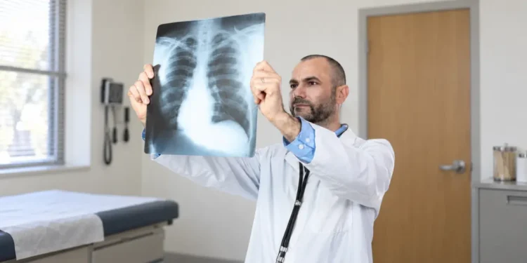 Od oktobra šira primena imunoterapije za rak pluća u Srbiji
